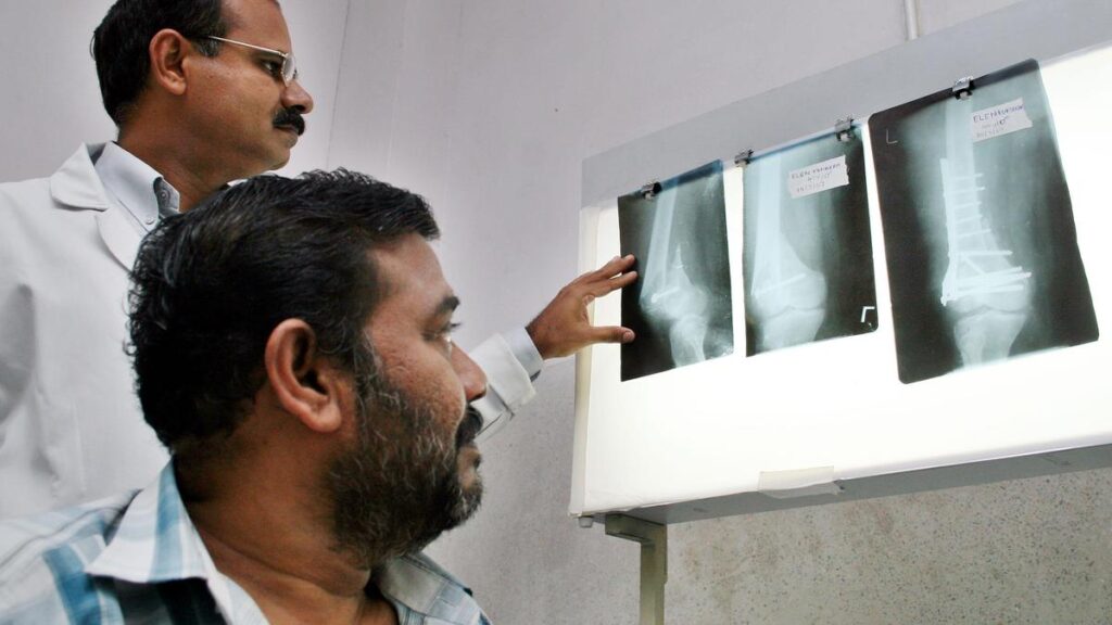 तनाव में कमजोरी: आपके कंकाल पर क्रॉनिक तनाव का छिपा हुआ प्रभाव